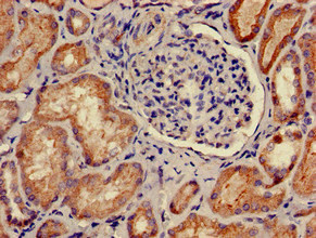 Immunohistochemistry of paraffin-embedded human kidney tissue using CSB-PA018689LA01HU at dilution of 1:100 Immunohistochemistry of paraffin-embedded human kidney tissue using CSB-PA018689LA01HU at dilution of 1:100