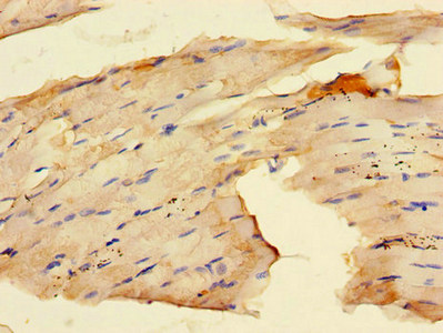 Immunohistochemistry of paraffin-embedded human skeletal muscle tissue using CSB-PA019179LA01HU at dilution of 1:100 Immunohistochemistry of paraffin-embedded human skeletal muscle tissue using CSB-PA019179LA01HU at dilution of 1:100