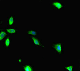 Immunofluorescent analysis of Hela cells using CSB-PA019308HA01HU at dilution of 1:100 and Alexa Fluor 488-congugated AffiniPure Goat Anti-Rabbit IgG(H+L)