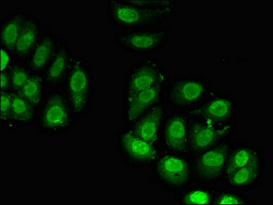 Immunofluorescent analysis of A549 cells using CSB-PA020187LA01HU at dilution of 1:100 and Alexa Fluor 488-congugated AffiniPure Goat Anti-Rabbit IgG(H+L)