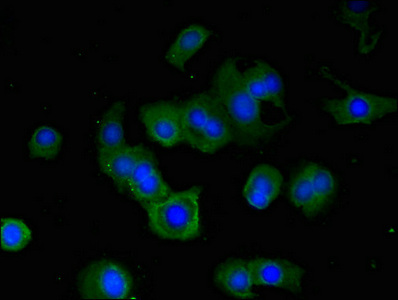 Immunofluorescent analysis of MCF-7 cells using CSB-PA020468LA01HU at dilution of 1:100 and Alexa Fluor 488-congugated AffiniPure Goat Anti-Rabbit IgG(H+L)
