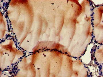 Immunohistochemistry of paraffin-embedded human thyroid tissue using CSB-PA020468LA01HU at dilution of 1:100