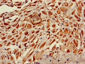 Immunohistochemistry of paraffin-embedded human placenta tissue using CSB-PA020468LA01HU at dilution of 1:100