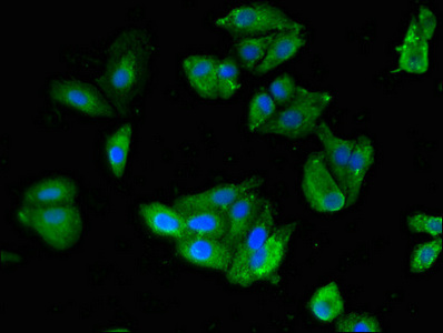 Immunofluorescent analysis of HepG2 cells using CSB-PA021357LA01HU at dilution of 1:100 and Alexa Fluor 488-congugated AffiniPure Goat Anti-Rabbit IgG(H+L)