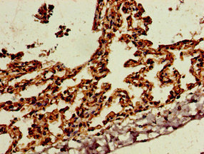 Immunohistochemistry of paraffin-embedded human lung tissue using CSB-PA021357LA01HU at dilution of 1:100