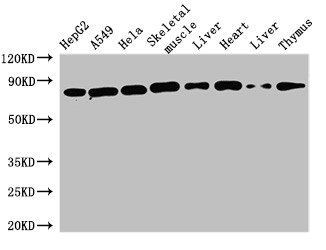 Western Blot Positive WB detected in: HepG2 whole cell lysate, A549 whole cell lysate, Hela whole cell lysate, Mouse skeletal muscle tissue, Mouse liver tissue, Rat heart tissue, Rat liver tissue, Rat thymus tissue All lanes: SKIL antibody at 1.6microg/ml Secondary Goat polyclonal to rabbit IgG at 1/50000 dilution Predicted band size: 77, 47, 72, 45, 75 kDa Observed band size: 77 kDa Western Blot Positive WB detected in: HepG2 whole cell lysate, A549 whole cell lysate, Hela whole cell lysate, Mouse skeletal muscle tissue, Mouse liver tissue, Rat heart tissue, Rat liver tissue, Rat thymus tissue All lanes: SKIL antibody at 1.6microg/ml Secondary Goat polyclonal to rabbit IgG at 1/50000 dilution Predicted band size: 77, 47, 72, 45, 75 kDa Observed band size: 77 kDa