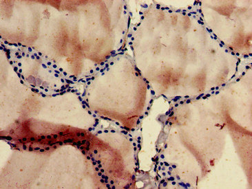 Immunohistochemistry of paraffin-embedded human thyroid tissue using CSB-PA021375LA01HU at dilution of 1:100