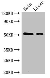 Western Blot Positive WB detected in: Hela whole cell lysate, Rat liver tissue All lanes: SLC10A3 antibody at 2microg/ml Secondary Goat polyclonal to rabbit IgG at 1/50000 dilution Predicted band size: 51, 48 kDa Observed band size: 51 kDa Western Blot Positive WB detected in: Hela whole cell lysate, Rat liver tissue All lanes: SLC10A3 antibody at 2microg/ml Secondary Goat polyclonal to rabbit IgG at 1/50000 dilution Predicted band size: 51, 48 kDa Observed band size: 51 kDa