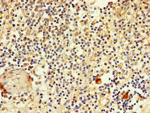 Immunohistochemistry of paraffin-embedded human spleen tissue using CSB-PA021553LA01HU at dilution of 1:100 Immunohistochemistry of paraffin-embedded human spleen tissue using CSB-PA021553LA01HU at dilution of 1:100