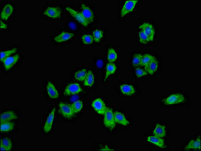 Immunofluorescent analysis of HepG2 cells using CSB-PA021701LA01HU at dilution of 1:100 and Alexa Fluor 488-congugated AffiniPure Goat Anti-Rabbit IgG(H+L)
