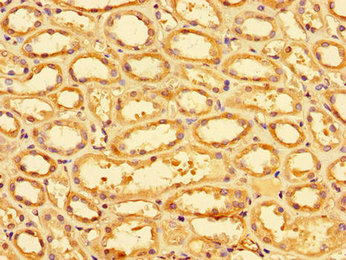 Immunohistochemistry of paraffin-embedded human kidney tissue using CSB-PA021726LA01HU at dilution of 1:100
