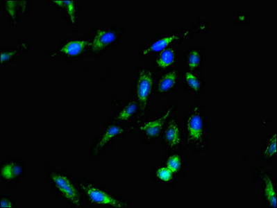 Immunofluorescent analysis of Hela cells using CSB-PA021854LA01HU at dilution of 1:100 and Alexa Fluor 488-congugated AffiniPure Goat Anti-Rabbit IgG(H+L)