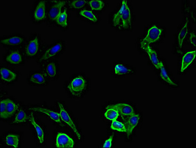 Immunofluorescent analysis of Hela cells using CSB-PA021869LA01HU at dilution of 1:100 and Alexa Fluor 488-congugated AffiniPure Goat Anti-Rabbit IgG(H+L)