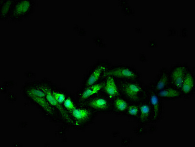 Immunofluorescent analysis of HepG2 cells using CSB-PA022396LA01HU at dilution of 1:100 and Alexa Fluor 488-congugated AffiniPure Goat Anti-Rabbit IgG(H+L)