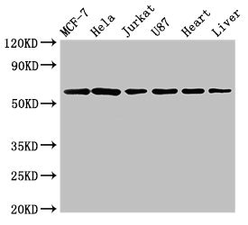Western Blot Positive WB detected in: MCF-7 whole cell lysate, Hela whole cell lysate, Jurkat whole cell lysate, U87 whole cell lysate, Rat heart tissue, Rat liver tissue All lanes: SOCS7 antibody at 3microg/ml Secondary Goat polyclonal to rabbit IgG at 1/50000 dilution Predicted band size: 63, 38 kDa Observed band size: 63 kDa Western Blot Positive WB detected in: MCF-7 whole cell lysate, Hela whole cell lysate, Jurkat whole cell lysate, U87 whole cell lysate, Rat heart tissue, Rat liver tissue All lanes: SOCS7 antibody at 3microg/ml Secondary Goat polyclonal to rabbit IgG at 1/50000 dilution Predicted band size: 63, 38 kDa Observed band size: 63 kDa
