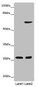 Western blot All lanes: SOX14 antibody at 14ug/ml Lane 1: Human placenta tissue Lane 2: HepG2 whole cell lysate Secondary Goat polyclonal to rabbit IgG at 1/10000 dilution Predicted band size: 27 kDa Observed band size: 27 kDa Western blot All lanes: SOX14 antibody at 14ug/ml Lane 1: Human placenta tissue Lane 2: HepG2 whole cell lysate Secondary Goat polyclonal to rabbit IgG at 1/10000 dilution Predicted band size: 27 kDa Observed band size: 27 kDa