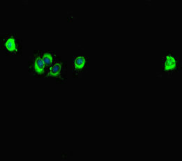 Immunofluorescent analysis of Hela cells using CSB-PA022470LA01HU at dilution of 1:100 and Alexa Fluor 488-congugated AffiniPure Goat Anti-Rabbit IgG(H+L)