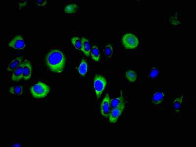 Immunofluorescent analysis of A549 cells using CSB-PA022585LA01HU at dilution of 1:100 and Alexa Fluor 488-congugated AffiniPure Goat Anti-Rabbit IgG(H+L)