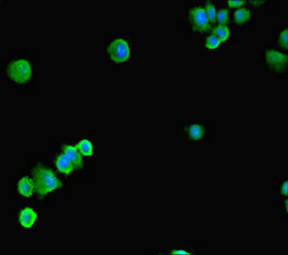 Immunofluorescent analysis of HepG2 cells using CSB-PA022721LA01HU at dilution of 1:100 and Alexa Fluor 488-congugated AffiniPure Goat Anti-Rabbit IgG(H+L) Immunofluorescent analysis of HepG2 cells using CSB-PA022721LA01HU at dilution of 1:100 and Alexa Fluor 488-congugated AffiniPure Goat Anti-Rabbit IgG(H+L)