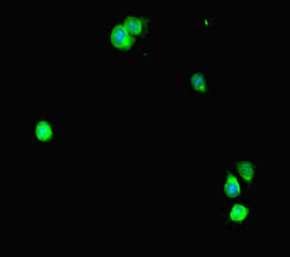 Immunofluorescent analysis of Hela cells using CSB-PA022811LA01HU at dilution of 1:100 and Alexa Fluor 488-congugated AffiniPure Goat Anti-Rabbit IgG(H+L)