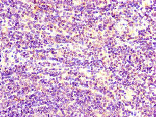 Immunohistochemistry of paraffin-embedded human lymph node tissue using CSB-PA022829LA01HU at dilution of 1:100 Immunohistochemistry of paraffin-embedded human lymph node tissue using CSB-PA022829LA01HU at dilution of 1:100