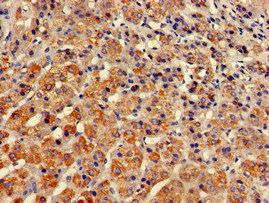 Immunohistochemistry of paraffin-embedded human adrenal gland tissue using CSB-PA022907LA01HU at dilution of 1:100