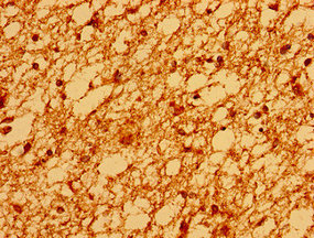 Immunohistochemistry of paraffin-embedded human brain tissue using CSB-PA022978LA01HU at dilution of 1:100 Immunohistochemistry of paraffin-embedded human brain tissue using CSB-PA022978LA01HU at dilution of 1:100