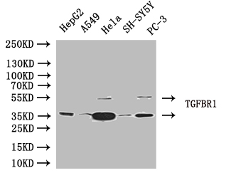 Western Blot Positive WB detected in: Jurkat whole cell lysate, SH-SY5Y whole cell lysate All lanes: TGFBR1 antibody at 4microg/ml Secondary Goat polyclonal to rabbit IgG at 1/50000 dilution Predicted band size: 56, 57, 48 kDa Observed band size: 56 kDa Western Blot Positive WB detected in: Jurkat whole cell lysate, SH-SY5Y whole cell lysate All lanes: TGFBR1 antibody at 4microg/ml Secondary Goat polyclonal to rabbit IgG at 1/50000 dilution Predicted band size: 56, 57, 48 kDa Observed band size: 56 kDa