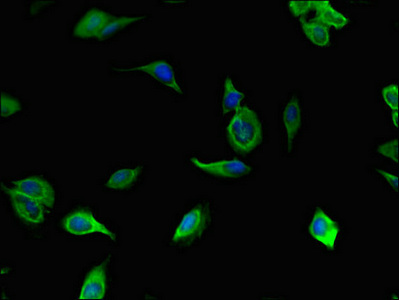 Immunofluorescent analysis of Hela cells using CSB-PA023595LA01HU at dilution of 1:100 and Alexa Fluor 488-congugated AffiniPure Goat Anti-Rabbit IgG(H+L)