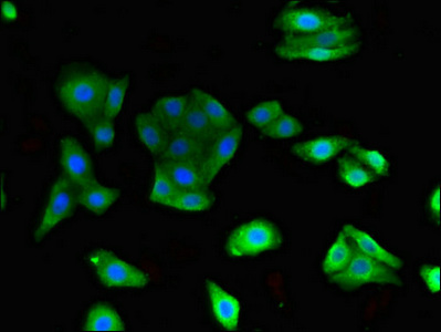 Immunofluorescent analysis of HepG2 cells using CSB-PA023608LA01HU at dilution of 1:100 and Alexa Fluor 488-congugated AffiniPure Goat Anti-Rabbit IgG(H+L)