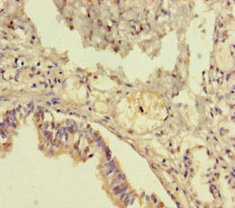 Immunohistochemistry of paraffin-embedded human lung tissue using CSB-PA023868LA01HU at dilution of 1:100