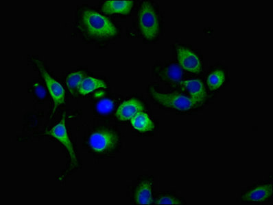 Immunofluorescence(IF) - TNFRSF10A Antibody