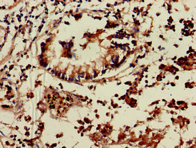 Immunohistochemistry of paraffin-embedded human appendix tissue using CSB-PA023998LA01HU at dilution of 1:100 Immunohistochemistry of paraffin-embedded human appendix tissue using CSB-PA023998LA01HU at dilution of 1:100