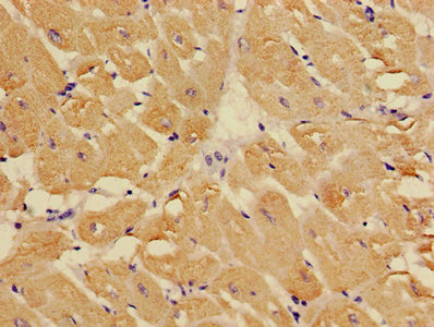 Immunohistochemistry of paraffin-embedded human heart tissue using CSB-PA024009LA01HU at dilution of 1:100