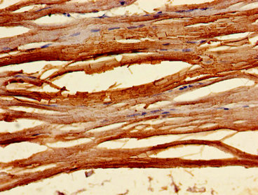 Immunohistochemistry of paraffin-embedded human skeletal muscle tissue using CSB-PA024009LA01HU at dilution of 1:100