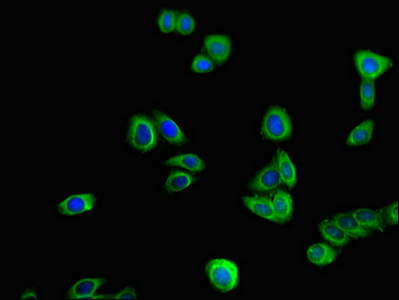 Immunofluorescent analysis of HepG2 cells using CSB-PA024067LA01HU at dilution of 1:100 and Alexa Fluor 488-congugated AffiniPure Goat Anti-Rabbit IgG(H+L)