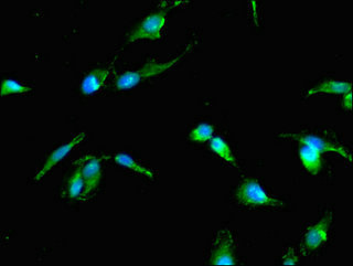 Immunofluorescent analysis of Hela cells using CSB-PA024082LA01HU at dilution of 1:100 and Alexa Fluor 488-congugated AffiniPure Goat Anti-Rabbit IgG(H+L) Immunofluorescent analysis of Hela cells using CSB-PA024082LA01HU at dilution of 1:100 and Alexa Fluor 488-congugated AffiniPure Goat Anti-Rabbit IgG(H+L)
