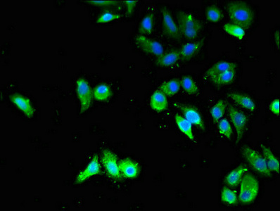 Immunofluorescent analysis of HepG2 cells using CSB-PA024106LA01HU at dilution of 1:100 and Alexa Fluor 488-congugated AffiniPure Goat Anti-Rabbit IgG(H+L)