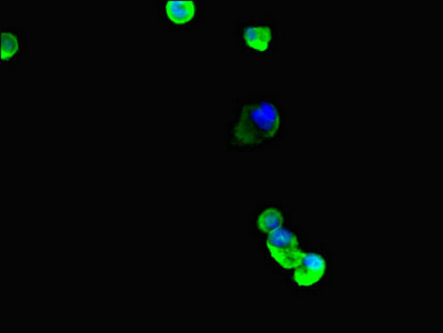 Immunofluorescent analysis of MCF-7 cells using CSB-PA025324LA01HU at dilution of 1:100 and Alexa Fluor 488-congugated AffiniPure Goat Anti-Rabbit IgG(H+L)