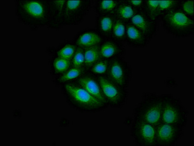 Immunofluorescent analysis of A549 cells using CSB-PA025391LA01HU at dilution of 1:100 and Alexa Fluor 488-congugated AffiniPure Goat Anti-Rabbit IgG(H+L)