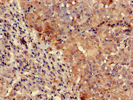 Immunohistochemistry of paraffin-embedded human adrenal gland tissue using CSB-PA025391LA01HU at dilution of 1:100 Immunohistochemistry of paraffin-embedded human adrenal gland tissue using CSB-PA025391LA01HU at dilution of 1:100