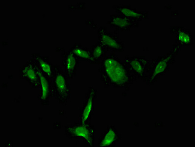 Immunofluorescent analysis of Hela cells using CSB-PA025393LA01HU at dilution of 1:100 and Alexa Fluor 488-congugated AffiniPure Goat Anti-Rabbit IgG(H+L)