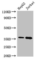 Western Blot Positive WB detected in: HepG2 whole cell lysate, Jurkat whole cell lysate All lanes: TYMS antibody at 2.4microg/ml Secondary Goat polyclonal to rabbit IgG at 1/50000 dilution Predicted band size: 36, 32, 27 kDa Observed band size: 36 kDa Western Blot Positive WB detected in: HepG2 whole cell lysate, Jurkat whole cell lysate All lanes: TYMS antibody at 2.4microg/ml Secondary Goat polyclonal to rabbit IgG at 1/50000 dilution Predicted band size: 36, 32, 27 kDa Observed band size: 36 kDa