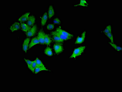 Immunofluorescent analysis of Hela cells using CSB-PA025466LA01HU at dilution of 1:100 and Alexa Fluor 488-congugated AffiniPure Goat Anti-Rabbit IgG(H+L) Immunofluorescent analysis of Hela cells using CSB-PA025466LA01HU at dilution of 1:100 and Alexa Fluor 488-congugated AffiniPure Goat Anti-Rabbit IgG(H+L)
