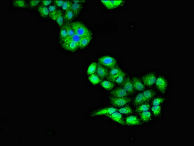 Immunofluorescent analysis of PC-3 cells using CSB-PA025612LA01HU at dilution of 1:100 and Alexa Fluor 488-congugated AffiniPure Goat Anti-Rabbit IgG(H+L) Immunofluorescent analysis of PC-3 cells using CSB-PA025612LA01HU at dilution of 1:100 and Alexa Fluor 488-congugated AffiniPure Goat Anti-Rabbit IgG(H+L)