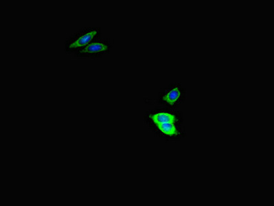 Immunofluorescent analysis of HepG2 cells using CSB-PA025710LA01HU at dilution of 1:100 and Alexa Fluor 488-congugated AffiniPure Goat Anti-Rabbit IgG(H+L)