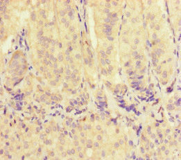 Immunohistochemistry of paraffin-embedded human adrenal gland tissue using CSB-PA025824LA01HU at dilution of 1:100 Immunohistochemistry of paraffin-embedded human adrenal gland tissue using CSB-PA025824LA01HU at dilution of 1:100