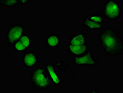 Immunofluorescent analysis of MCF-7 cells using CSB-PA025915LA01HU at dilution of 1:100 and Alexa Fluor 488-congugated AffiniPure Goat Anti-Rabbit IgG(H+L)