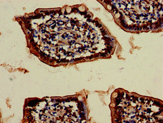Immunohistochemistry of paraffin-embedded human small intestine tissue using CSB-PA025915LA01HU at dilution of 1:100 Immunohistochemistry of paraffin-embedded human small intestine tissue using CSB-PA025915LA01HU at dilution of 1:100