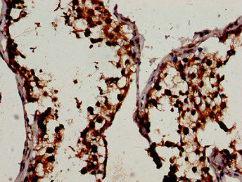 CSB-PA026113LA01HU